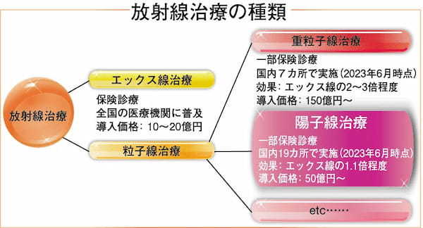 放射線治療の種類_図表