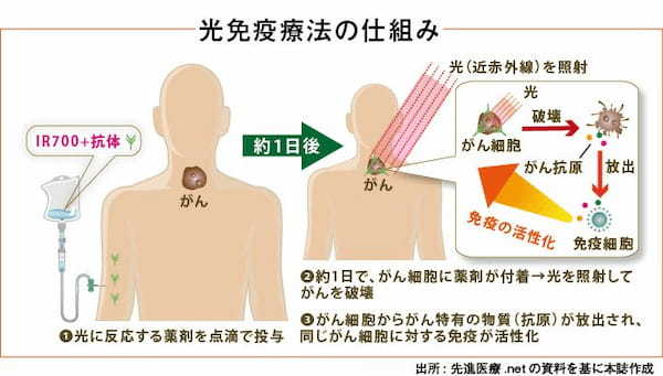 光免疫療法_図